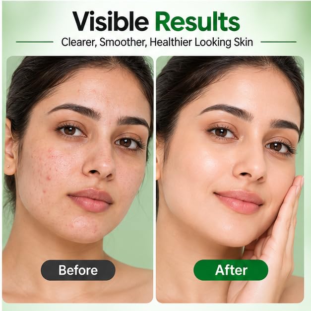 Xiraya 2% Salicylic Acid Face Serum for Oily & Blemish-Prone Skin, Helps Reduce Blemish Appearance, Unclogs Pores & Smooths Skin, Lightweight Clarifying Serum, 30 ml