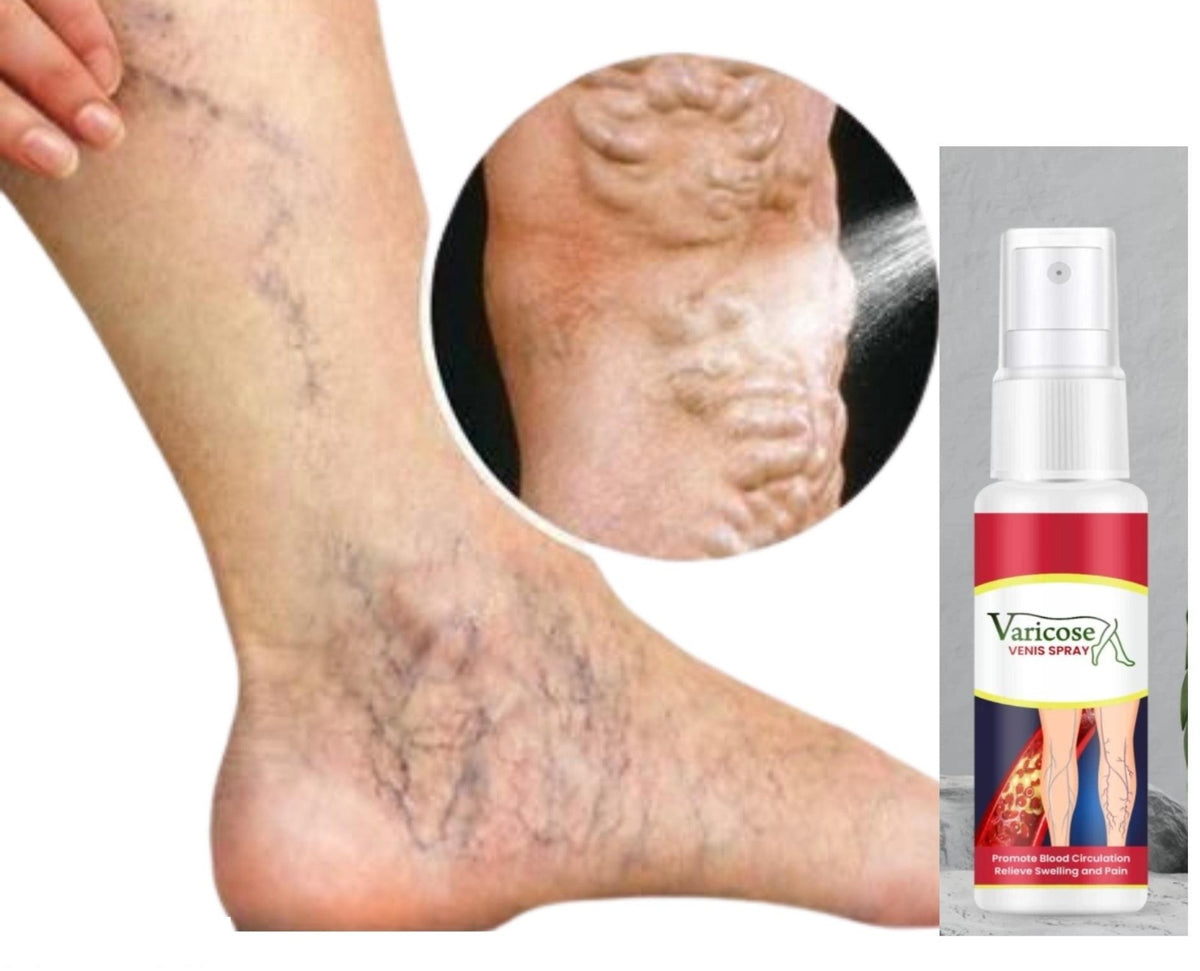 Varicose Vein Care Spray (Pack of 2)