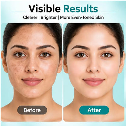 Xiraya 2% Alpha Arbutin Face Serum for Brighter Even Looking Skin, Dark Spot Appearance Care, Lightweight Daily Brightening Serum, Fast Absorbing Non Greasy Formula, 30 ml Skin