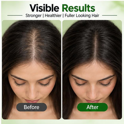 Xiraya Rosemary Hair Serum for All Hair Types, Scalp & Hair Root Nourishment, Helps Reduce Breakage, Hydrates Scalp & Hair, Supports Hair Softness & Manageability, 30 ml
