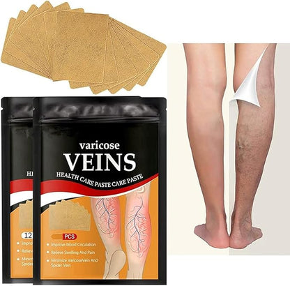 Varicose Vein Care Patches (12 Patches)