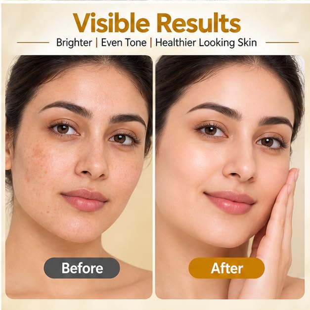Xiraya Skin Brightening Face Serum for Radiant Even-Looking Skin, Helps Reduce Appearance of Dark Spots, Daily Glow & Luminosity Serum, Suitable for All Skin Types, 30 ml