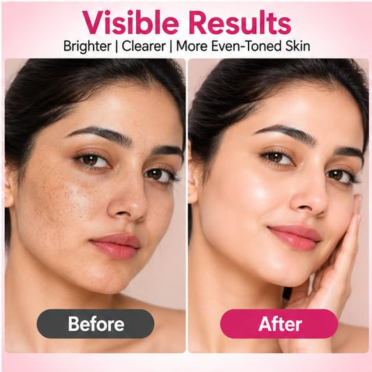 Xiraya Spot Reduction Face Serum for Brighter Even Looking Skin, Dark Spot Appearance Care, Radiance & Glow Support, Lightweight Daily Facial Serum, Non Greasy Formula, 30 ml