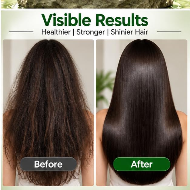 Xiraya Rosemary Conditioner 200 ml with Rosemary Extract & Natural Actives for Hair and Scalp, Nourishing Strengthening Conditioner for Healthy, Stronger & Shinier Hair