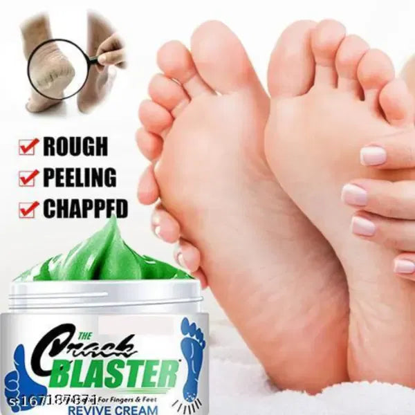 Foot Crack Repair Cream (50g) | Dry & Cracked Heel Care