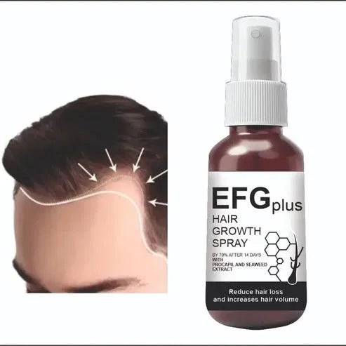 RevitaRoot Hair Growth Spray  (Pack of 2)