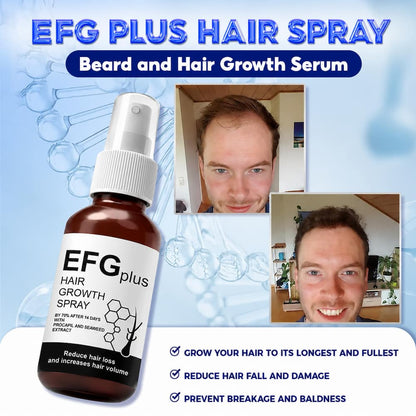Revita Root Hair Growth Spray  (Pack of 2)