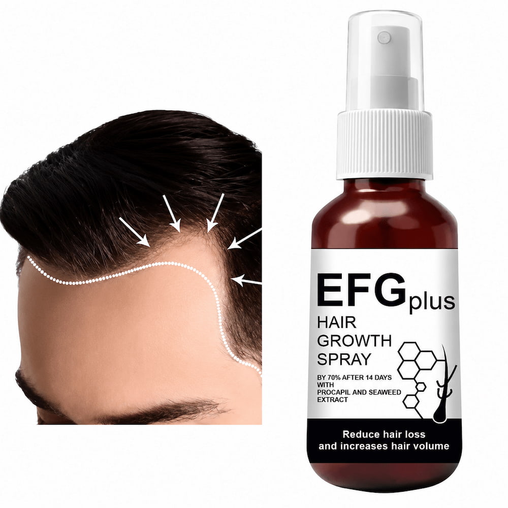 Revita Root Hair Growth Spray  (Pack of 2)